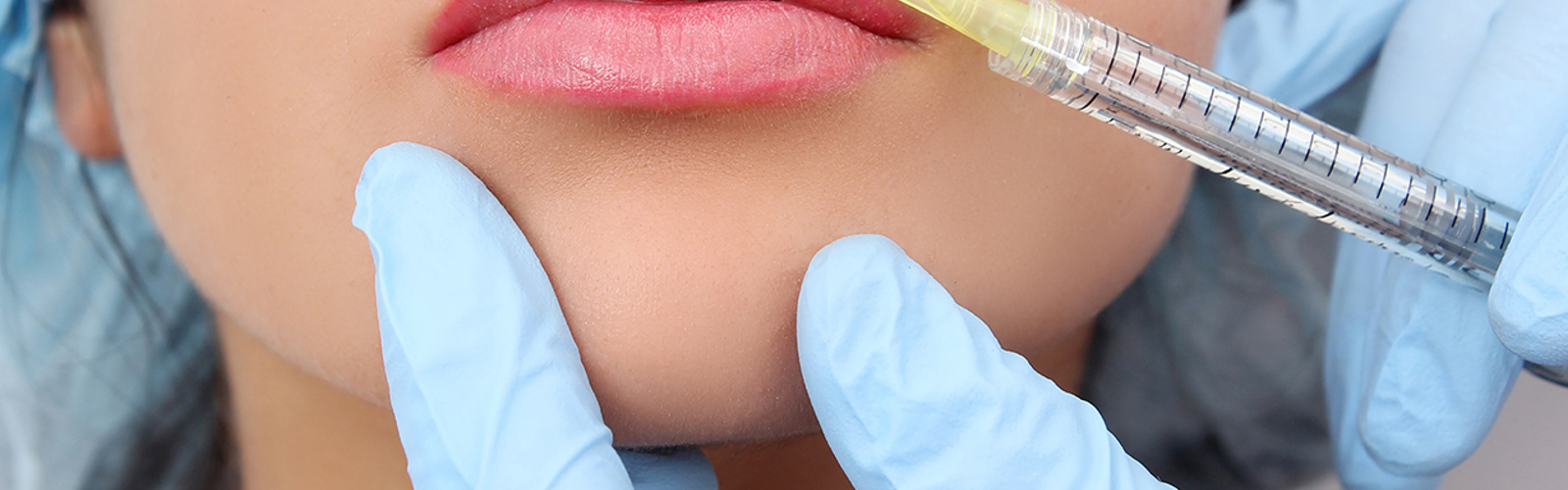 Needle administering a lip filler