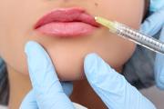 Needle administering a lip filler