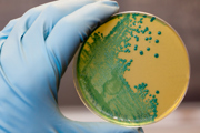 Listeria in a Petri dish