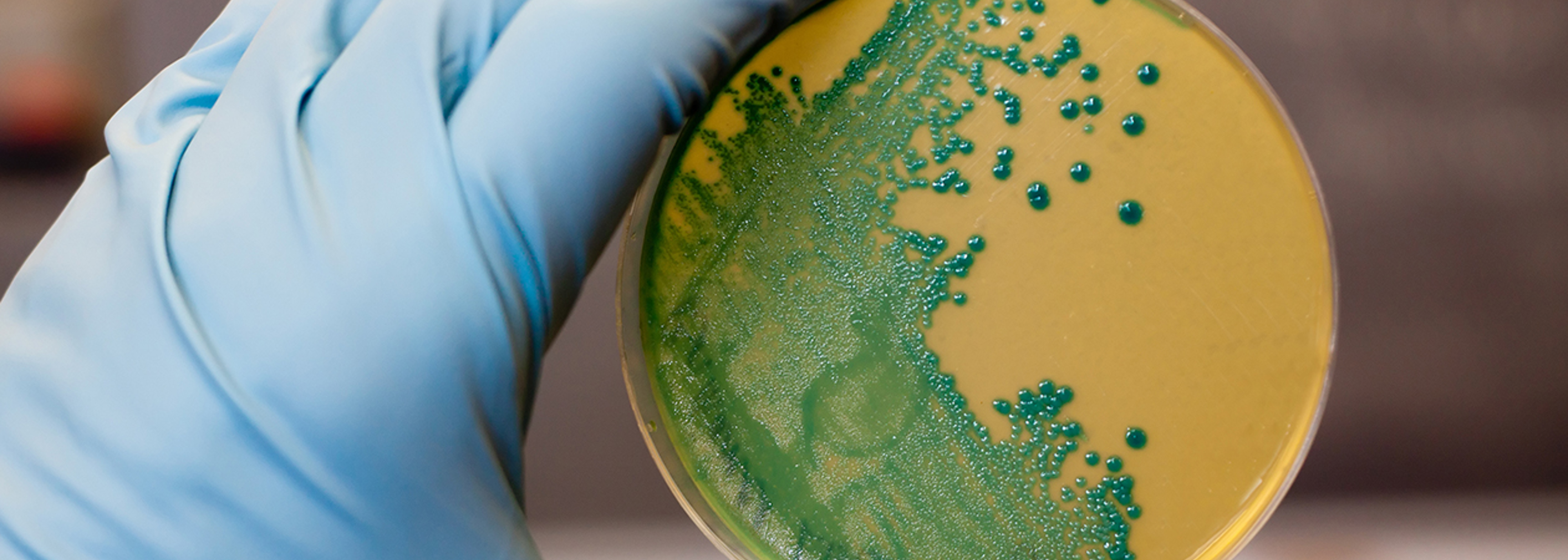 Three patients die from listeria in sandwiches