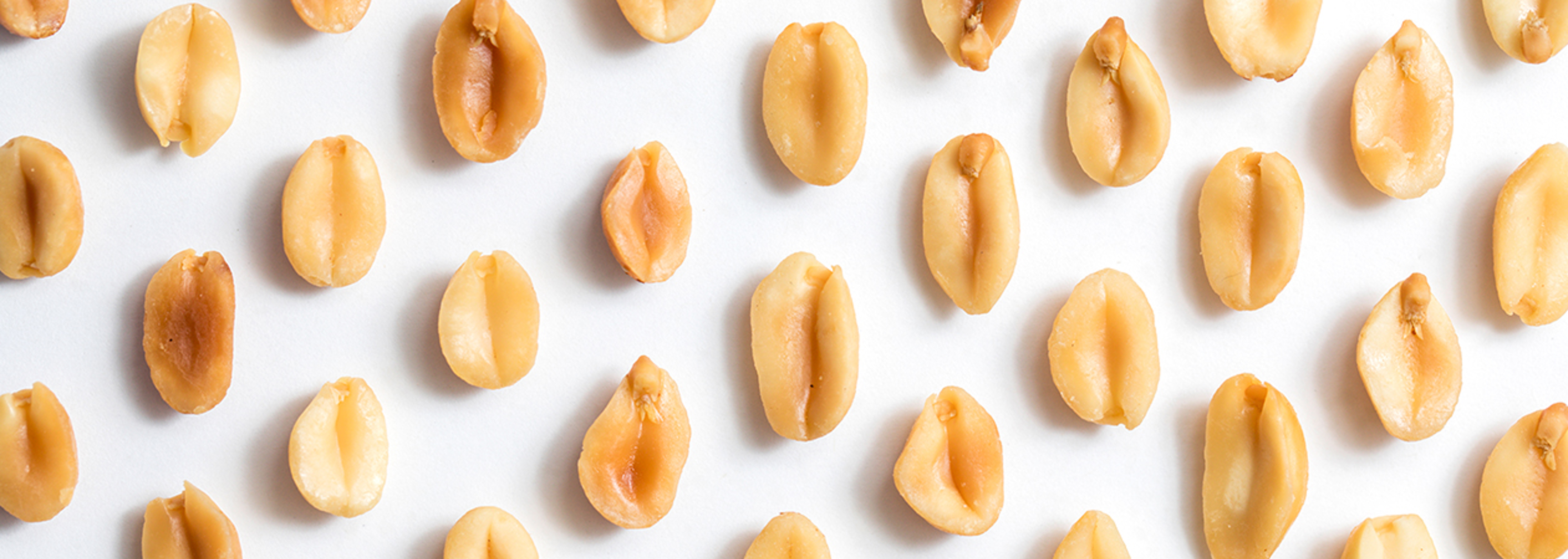 CIEH urges caution over allergen addition to FHRS
