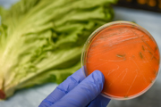 Listeria cultured on a petri dish