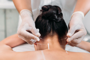 A women receiving acupuncture treatment to the neck.