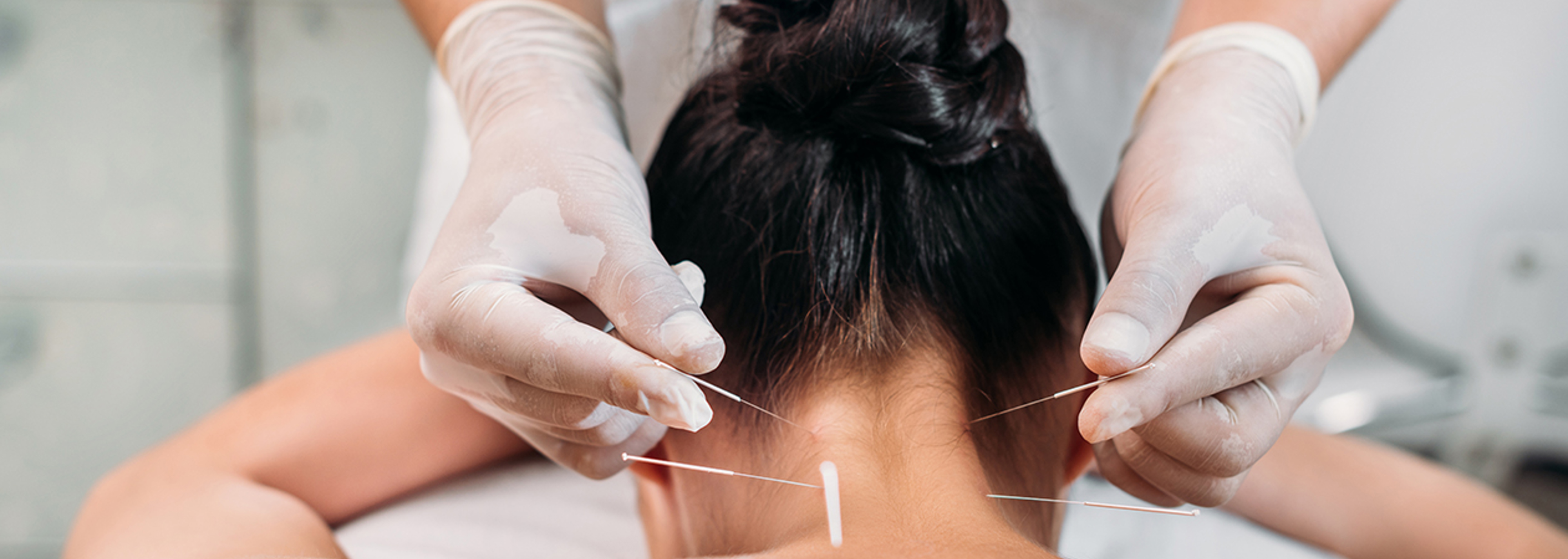 Unlicensed acupuncturist who burnt customer given suspended sentence