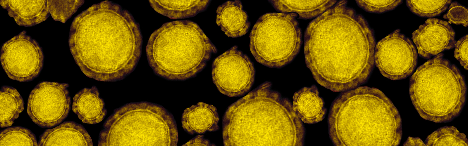 Detail of ultraestructure of deadly coronavirus particles under transmission electron microscopy