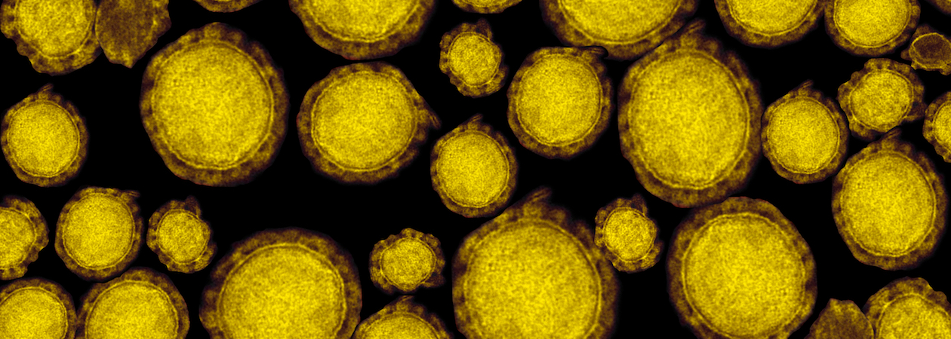 Natural environment must be protected to prevent future disease